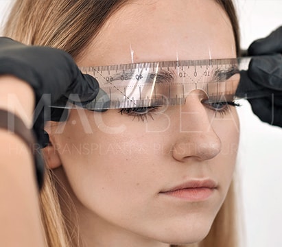 İğnesiz Anestezi ve Traşsız DHI Teknikle Kaş Ekimi